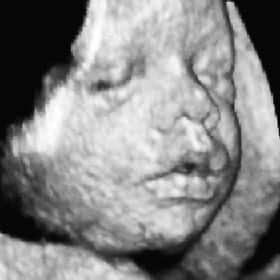 Эмбрион на 30 неделе