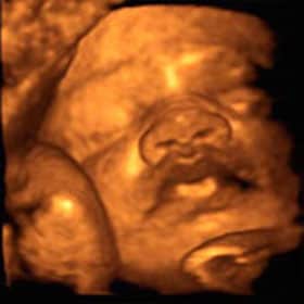 Эмбрион на 33 неделе