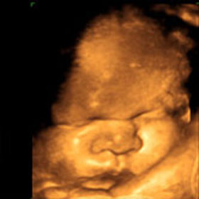 Эмбрион на 38 неделе