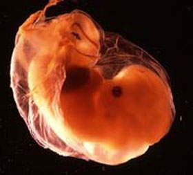 Эмбрион на 8 неделе