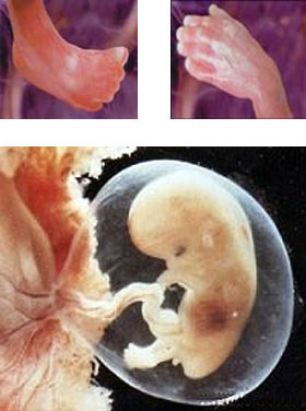 Эмбрион на 10 неделе
