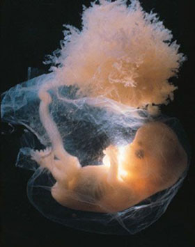 Эмбрион на 10 неделе