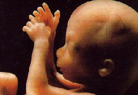 Эмбрион на 18 неделе