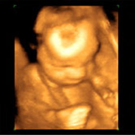 Эмбрион на 25 неделе беременности