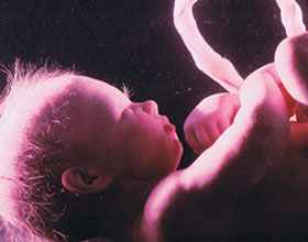 Эмбрион на 26 неделе