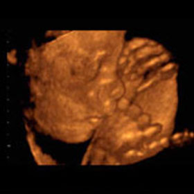 Эмбрион на 26 неделе