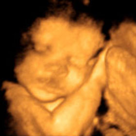 Эмбрион на 27 неделе