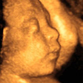 Эмбрион на 28 неделе