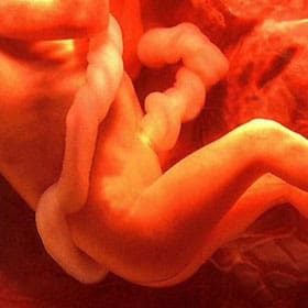 Эмбрион на 29 неделе