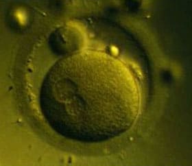 Оплодотворенная яйцеклетка