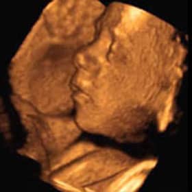 Эмбрион на 31 неделе