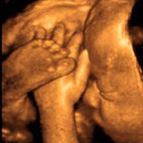 Эмбрион на 32 неделе