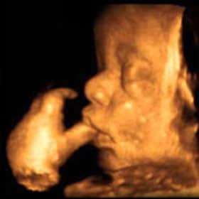 Эмбрион на 35 неделе