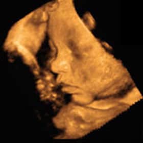 Эмбрион на 36 неделе