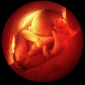 Эмбрион на 37 неделе
