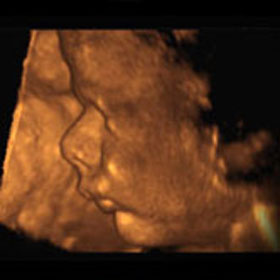Эмбрион на 37 неделе