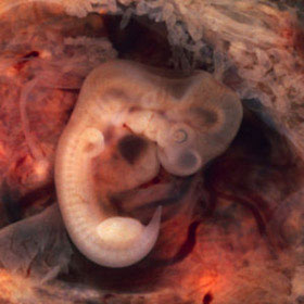Эмбрион на 4 неделе