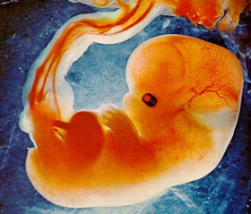 Эмбрион на 5 неделе