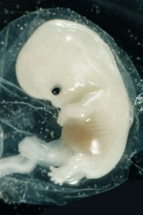 Эмбрион на 6 неделе