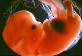 Эмбрион на 7 неделе