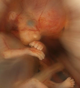 Эмбрион на 8 неделе