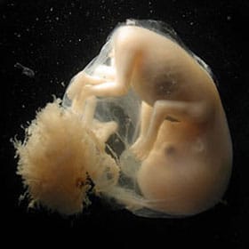 Эмбрион на 9 неделе